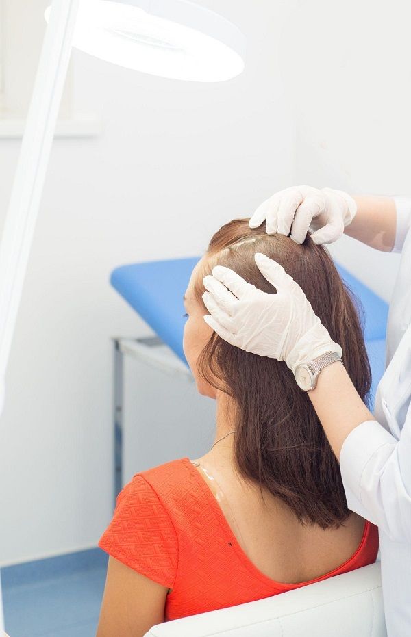 Causas de la alopecia femenina