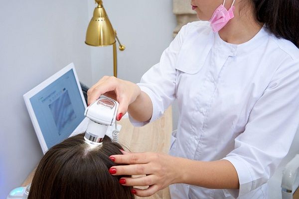 Diagnóstico de la alopecia en mujeres
