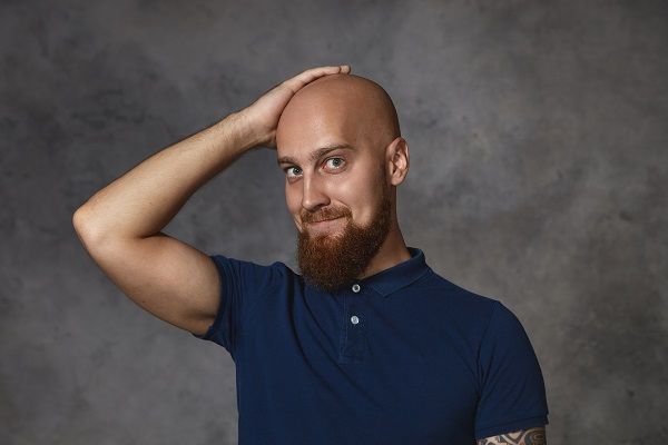 Hombre con alopecia de moda
