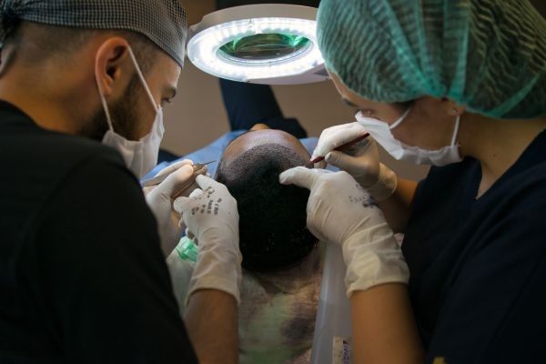 Doctores trabajando en un trasplante capilar