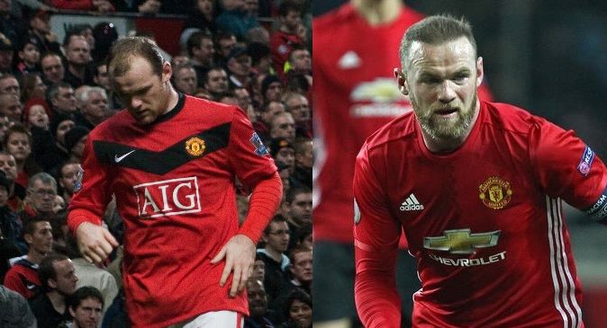 Imagen de antes y después del trasplante capilar de Wayne Rooney