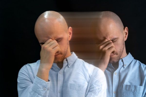 Hombre calvo sufriendo su alopecia