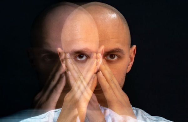 Hombre con alopecia sufriendo un impacto emocional