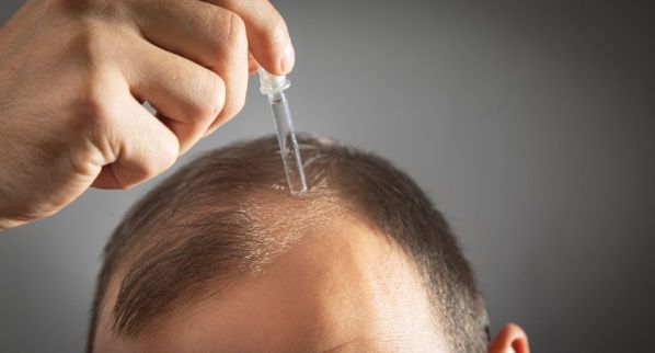 Protección del cabello trasplantado con productos capilares