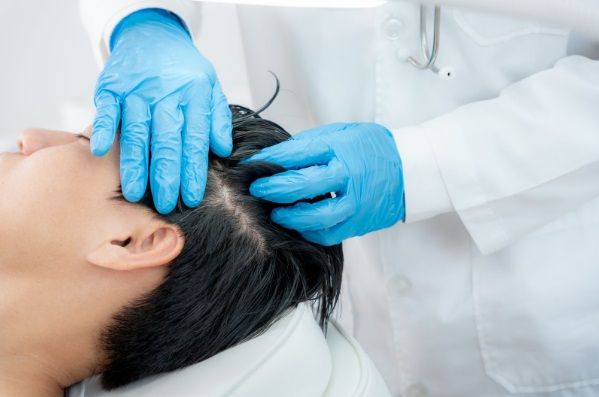 Revisión del cabello de un paciente por parte del especialista