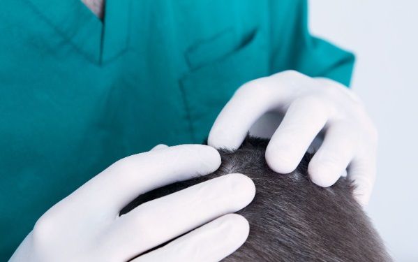 Revisión por parte del cirujano de un caso de alopecia