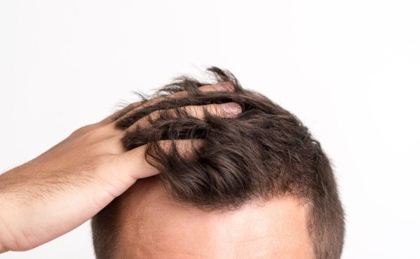 Hombre tocándose el pelo con la mano