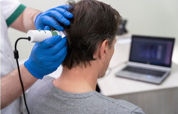 Tratamiento láser en el cabello a paciente