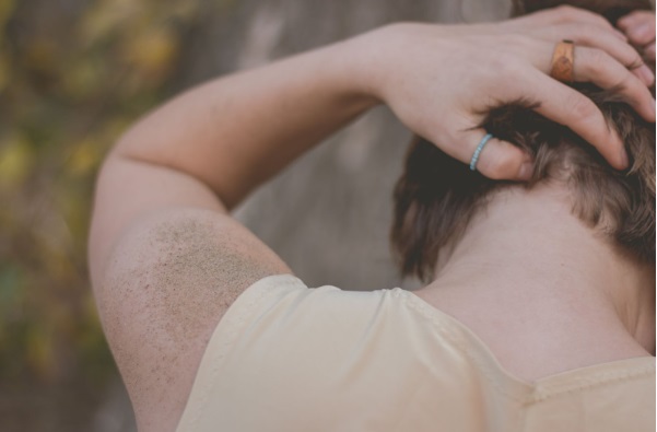 Hombre tocándose el pelo con dermatitis seborreica