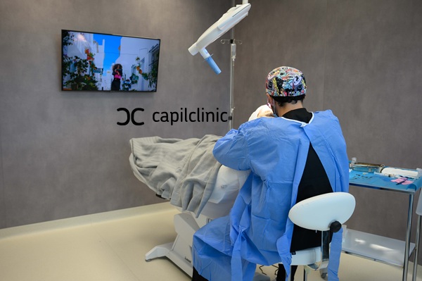Doctor de Capilclinic realizando un implante capilar en la clínica