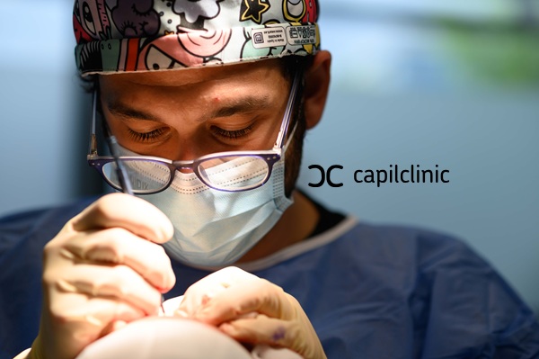 Doctor de Capilclinic realizando un implante capilar