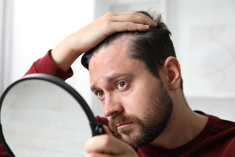 Hombre con alopecia preocupado delante del espejo