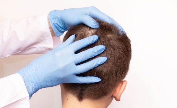 Hombre recibiendo una evaluación médica del experto capilar