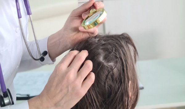 Médico revisando el cuero cabelludo del paciente
