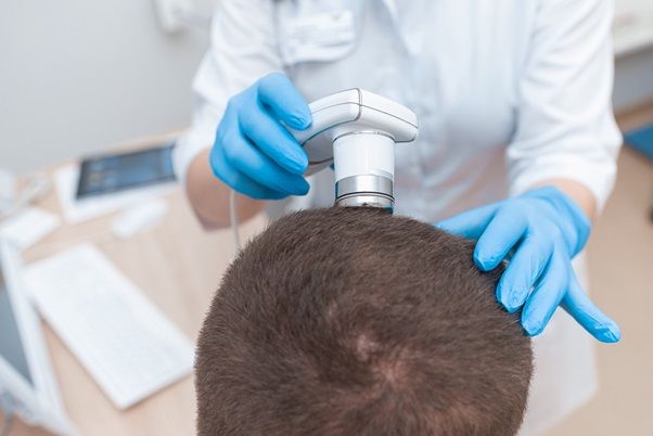 Seguimiento médico del trasplante de pelo