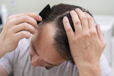 Hombre peinándose fuerte representando la alopecia por tracción