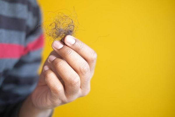 Efecto shedding de caída del pelo después de un tratamiento