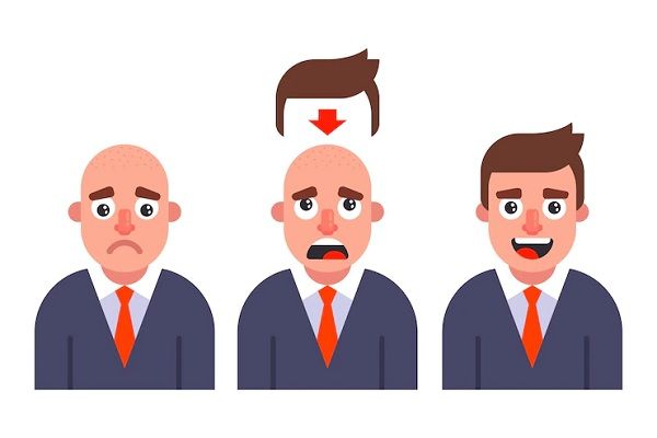 Sistema de integración capilar