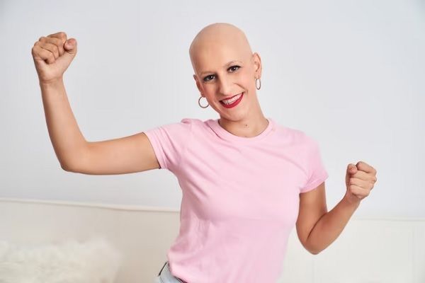 Pérdida de cabello por quimioterapia