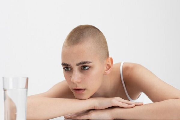 Pérdida de cabello por quimioterapia