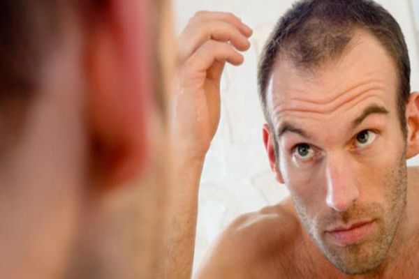 Hombre mirándose en el espejo como se le ha caído el pelo