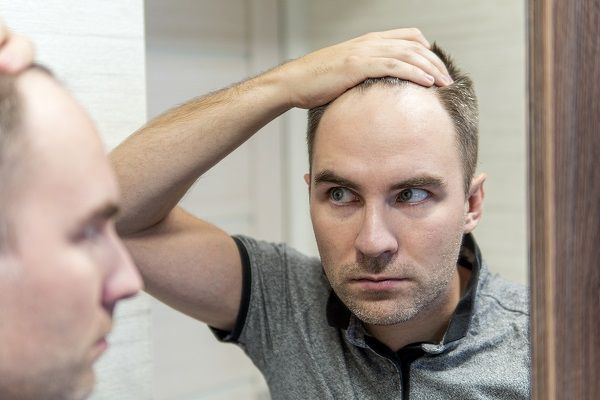 Hombre delante del espejo preocupado mirándose el pelo