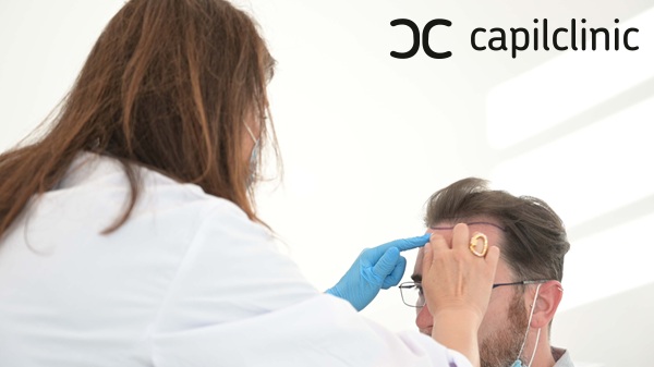 Cirujana capilar de Capilclinic realizando un diagnóstico previo