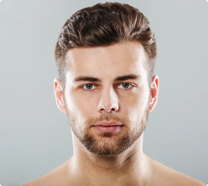 Permanent hair transplant